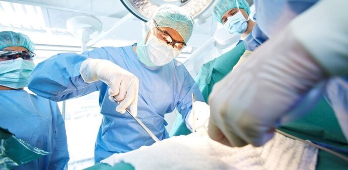 Operación para aumentar un membro